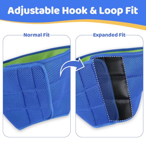 Soft Dog Cone Collar to Stop Licking After Surgery (Blue / M)